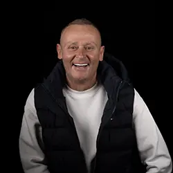 Case 2 after - All-on-4 dental implants